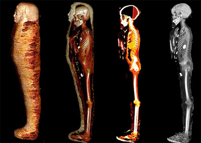 Radiologists Use CT Scans to 'Digitally Unwrap' Egypt's Mummified 'Golden Boy'